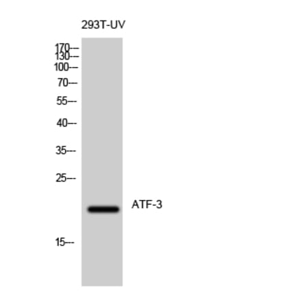 Western blot - ATF-3 Polyclonal Antibody from Signalway Antibody (40625) - Antibodies.com