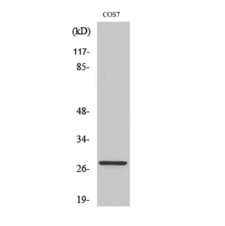 Western blot - Bcl-2 Polyclonal Antibody from Signalway Antibody (40638) - Antibodies.com