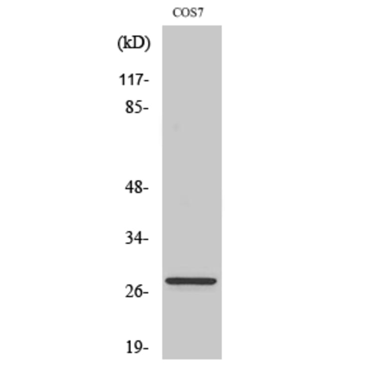 Western blot - Bcl-2 Polyclonal Antibody from Signalway Antibody (40638) - Antibodies.com