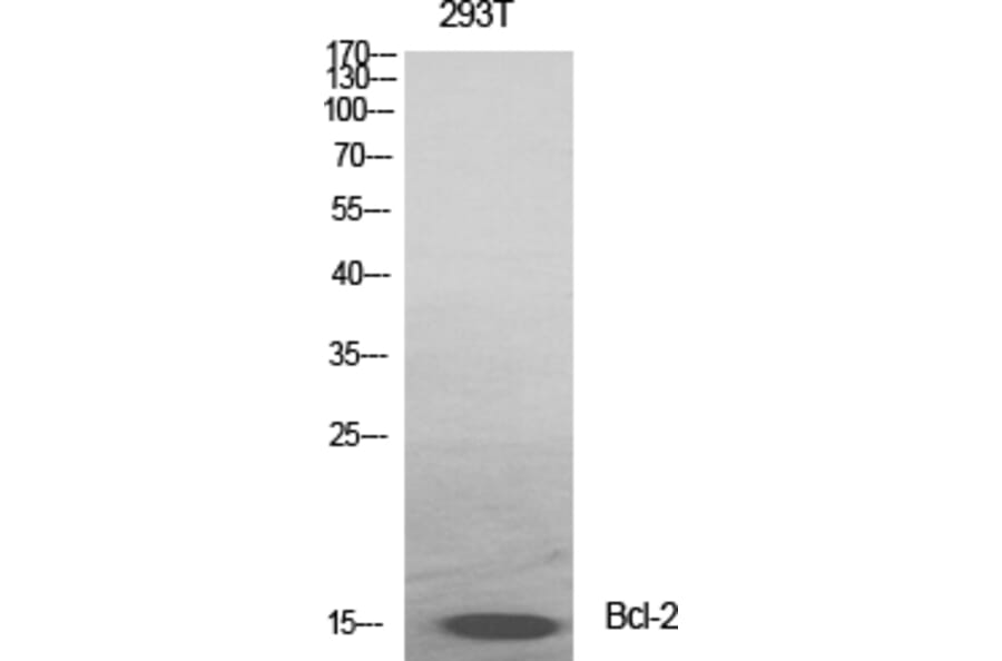 Western blot - Bcl-2 Polyclonal Antibody from Signalway Antibody (40638) - Antibodies.com