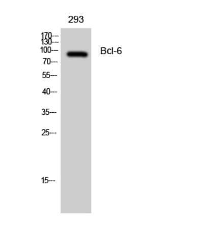 Western blot - Bcl-6 Polyclonal Antibody from Signalway Antibody (40640) - Antibodies.com