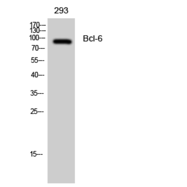 Western blot - Bcl-6 Polyclonal Antibody from Signalway Antibody (40640) - Antibodies.com