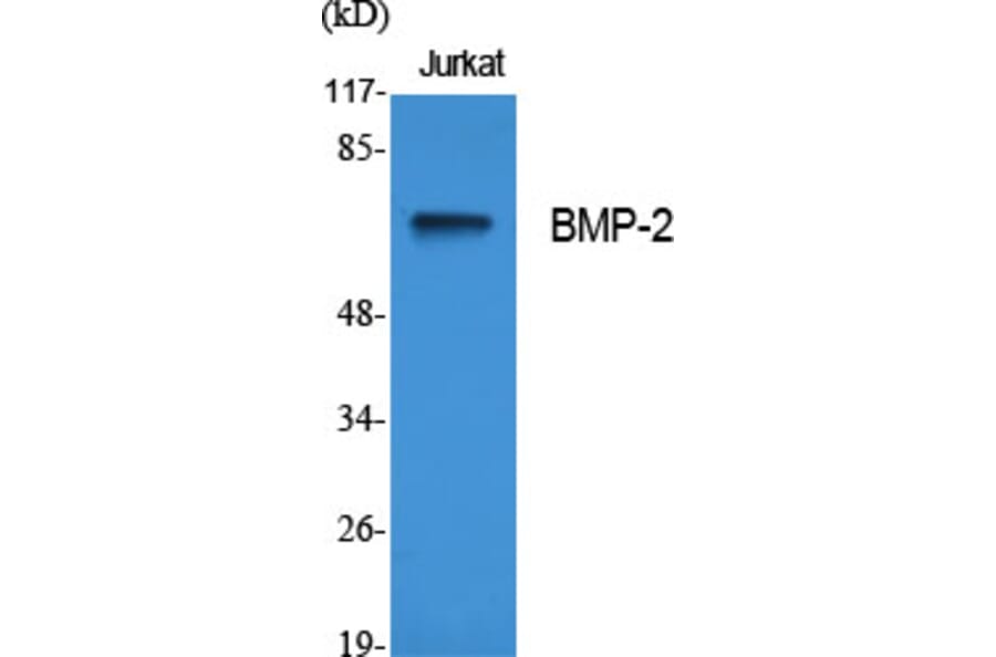 Western blot - BMP-2 Polyclonal Antibody from Signalway Antibody (40648) - Antibodies.com
