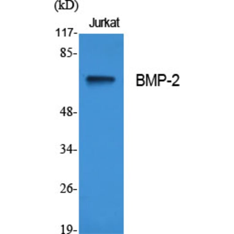 Western blot - BMP-2 Polyclonal Antibody from Signalway Antibody (40648) - Antibodies.com