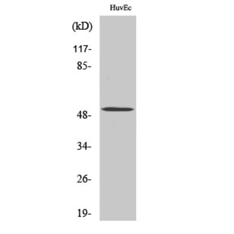 Western blot - BMP-5 Polyclonal Antibody from Signalway Antibody (40650) - Antibodies.com