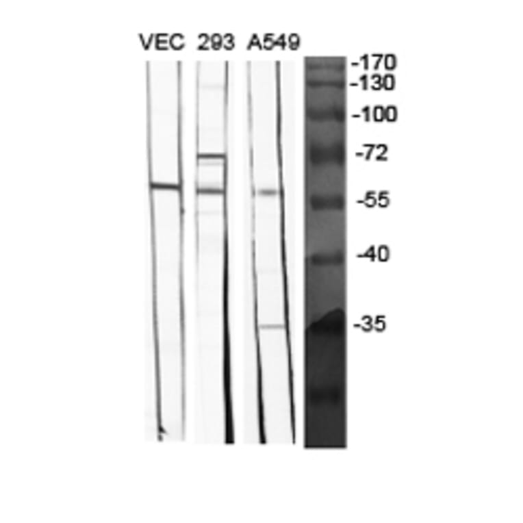 Western blot - BMP-5 Polyclonal Antibody from Signalway Antibody (40650) - Antibodies.com