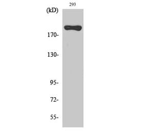 Western blot - BRCA1 Polyclonal Antibody from Signalway Antibody (40654) - Antibodies.com