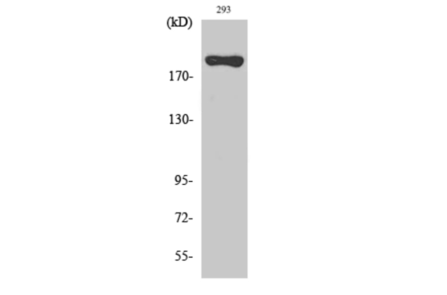 Western blot - BRCA1 Polyclonal Antibody from Signalway Antibody (40654) - Antibodies.com