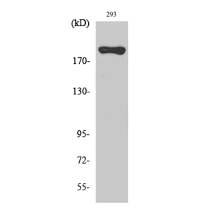 Western blot - BRCA1 Polyclonal Antibody from Signalway Antibody (40654) - Antibodies.com