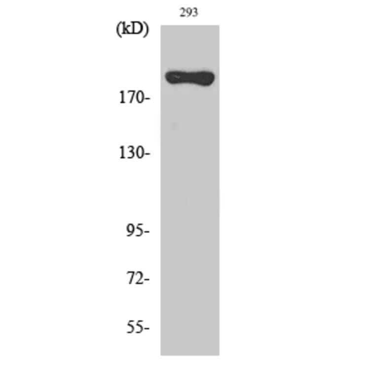 Western blot - BRCA1 Polyclonal Antibody from Signalway Antibody (40654) - Antibodies.com