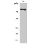 Western blot - BRCA1 Polyclonal Antibody from Signalway Antibody (40654) - Antibodies.com