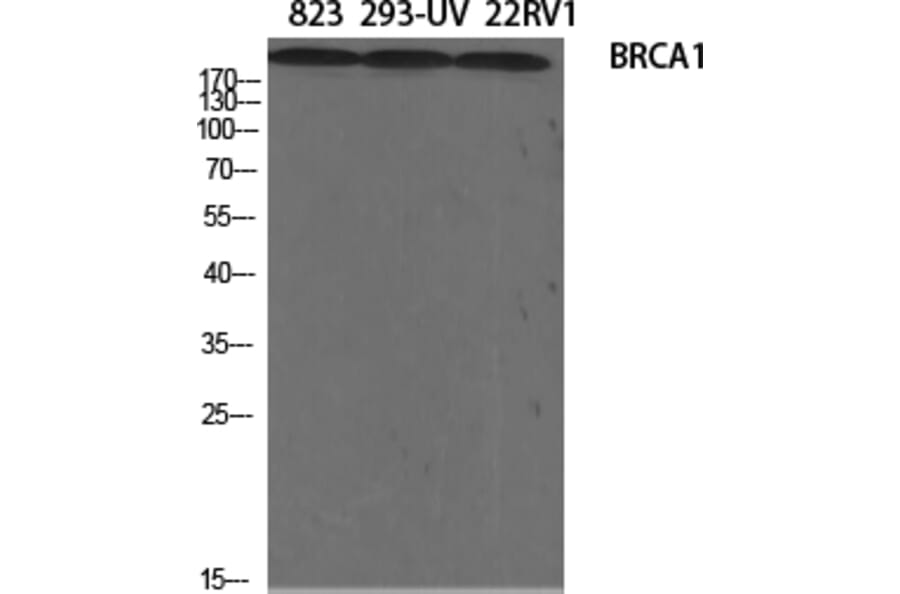 Western blot - BRCA1 Polyclonal Antibody from Signalway Antibody (40654) - Antibodies.com