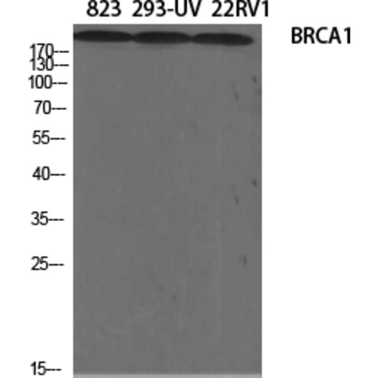 Western blot - BRCA1 Polyclonal Antibody from Signalway Antibody (40654) - Antibodies.com