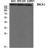 Western blot - BRCA1 Polyclonal Antibody from Signalway Antibody (40654) - Antibodies.com