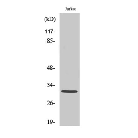 Western blot - C1QBP Polyclonal Antibody from Signalway Antibody (40661) - Antibodies.com