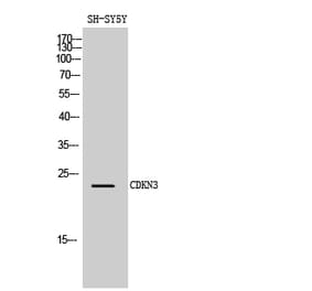 Western blot - CDKN3 Polyclonal Antibody from Signalway Antibody (40724) - Antibodies.com