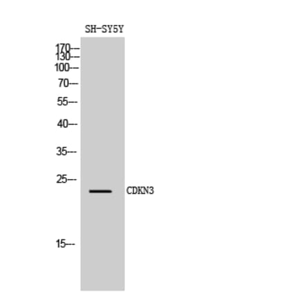 Western blot - CDKN3 Polyclonal Antibody from Signalway Antibody (40724) - Antibodies.com