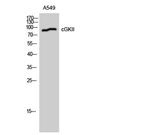 Western blot - cGKII Polyclonal Antibody from Signalway Antibody (40736) - Antibodies.com