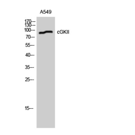 Western blot - cGKII Polyclonal Antibody from Signalway Antibody (40736) - Antibodies.com