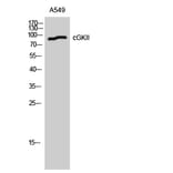 Western blot - cGKII Polyclonal Antibody from Signalway Antibody (40736) - Antibodies.com