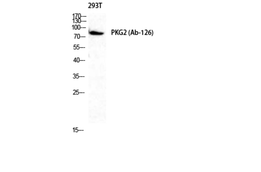 Western blot - cGKII Polyclonal Antibody from Signalway Antibody (40736) - Antibodies.com
