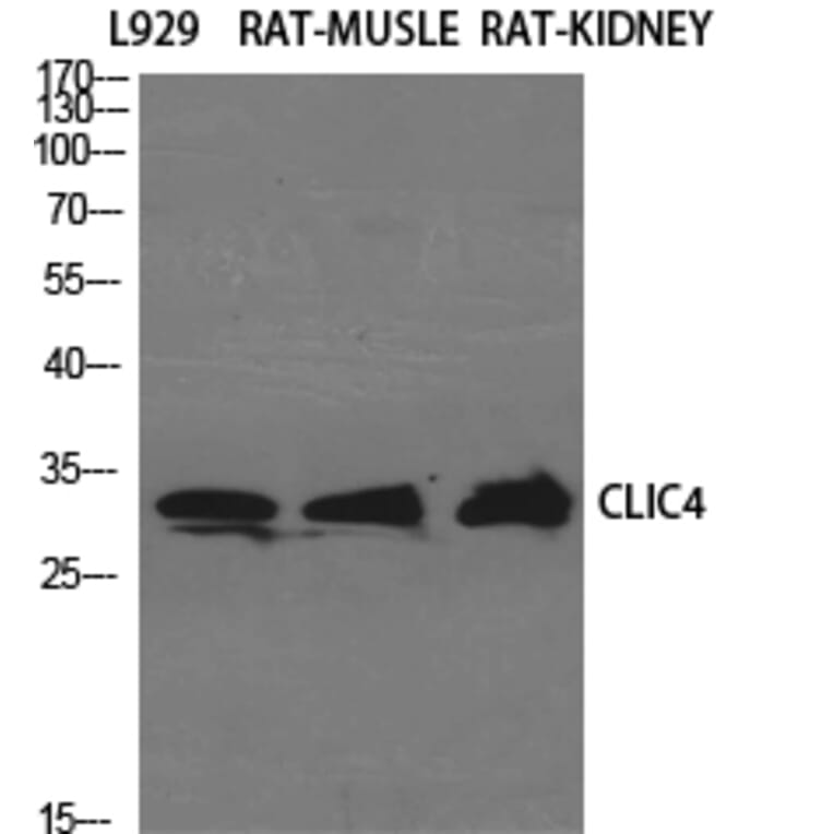 Western blot - CLIC4 Polyclonal Antibody from Signalway Antibody (40758) - Antibodies.com