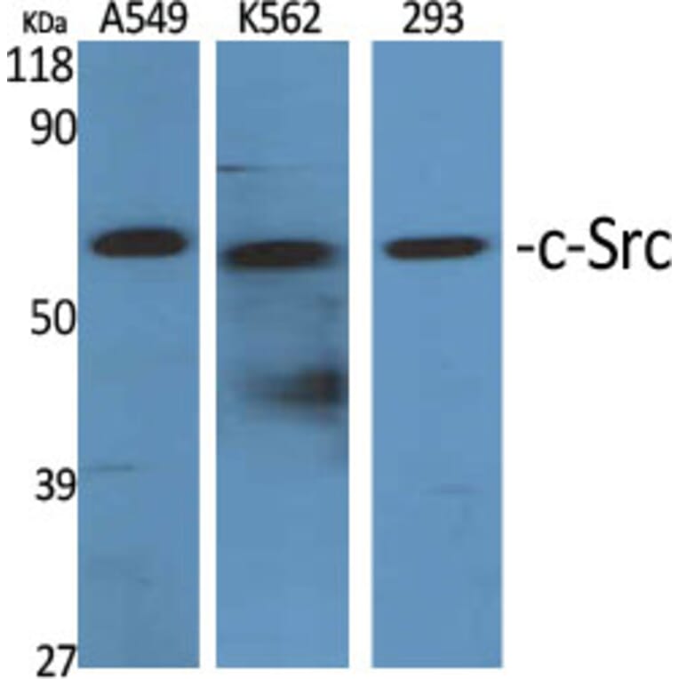 Western blot - c-Src Polyclonal Antibody from Signalway Antibody (40791) - Antibodies.com