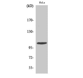 Western blot - eEF2K Polyclonal Antibody from Signalway Antibody (40862) - Antibodies.com