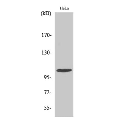 Western blot - eEF2K Polyclonal Antibody from Signalway Antibody (40862) - Antibodies.com
