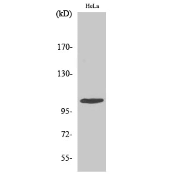 Western blot - eEF2K Polyclonal Antibody from Signalway Antibody (40862) - Antibodies.com