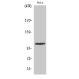 Western blot - eEF2K Polyclonal Antibody from Signalway Antibody (40862) - Antibodies.com