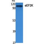 Western blot - eEF2K Polyclonal Antibody from Signalway Antibody (40862) - Antibodies.com