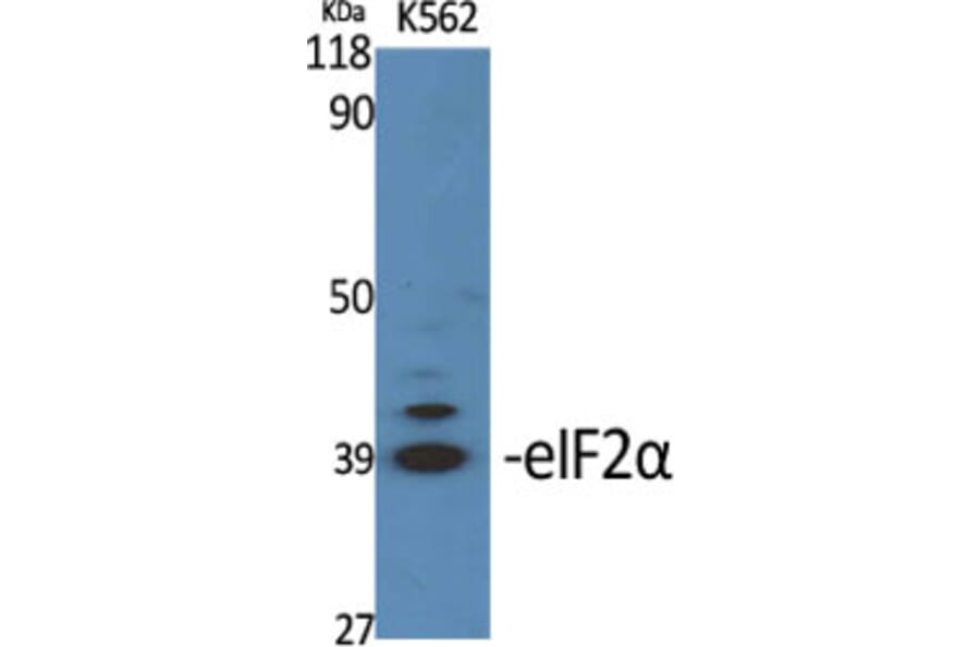 Western blot - eIF2α Polyclonal Antibody from Signalway Antibody (40870) - Antibodies.com