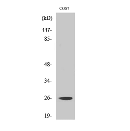 Western blot - eIF4E Polyclonal Antibody from Signalway Antibody (40871) - Antibodies.com