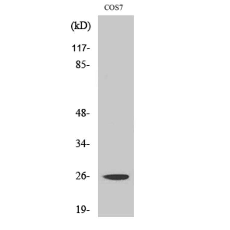 Western blot - eIF4E Polyclonal Antibody from Signalway Antibody (40871) - Antibodies.com