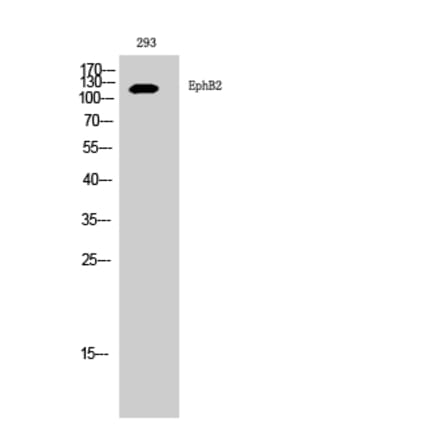 Western blot - EphB2 Polyclonal Antibody from Signalway Antibody (40890) - Antibodies.com