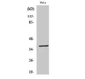 Western blot - ERdj3 Polyclonal Antibody from Signalway Antibody (40899) - Antibodies.com