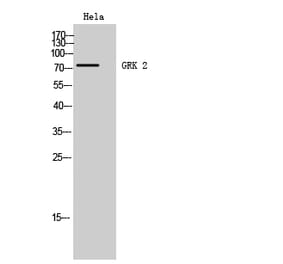 Western blot - GRK 2 Polyclonal Antibody from Signalway Antibody (40987) - Antibodies.com