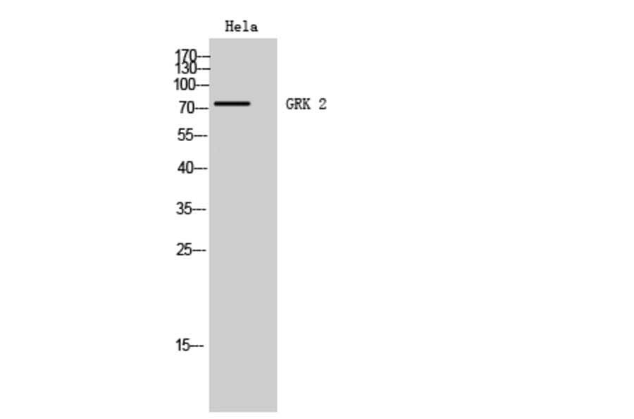 Western blot - GRK 2 Polyclonal Antibody from Signalway Antibody (40987) - Antibodies.com