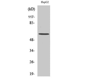 Western blot - HDAC2 Polyclonal Antibody from Signalway Antibody (40995) - Antibodies.com