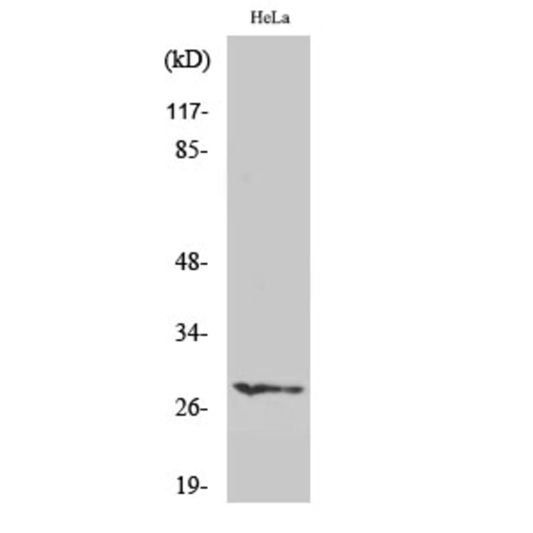 Western blot - HES-6 Polyclonal Antibody from Signalway Antibody (41003) - Antibodies.com