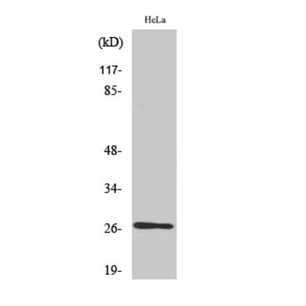 Western blot - HSP27 Polyclonal Antibody from Signalway Antibody (41045) - Antibodies.com