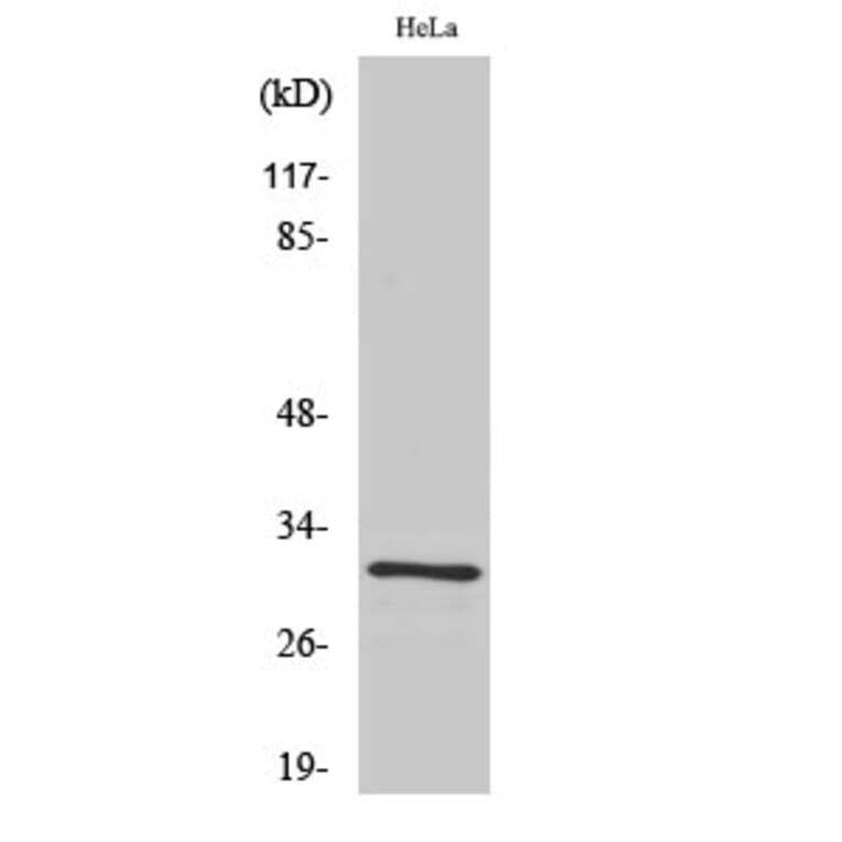 Western blot - IL-1β Polyclonal Antibody from Signalway Antibody (41059) - Antibodies.com