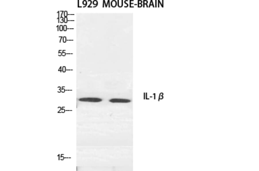 Western blot - IL-1β Polyclonal Antibody from Signalway Antibody (41059) - Antibodies.com