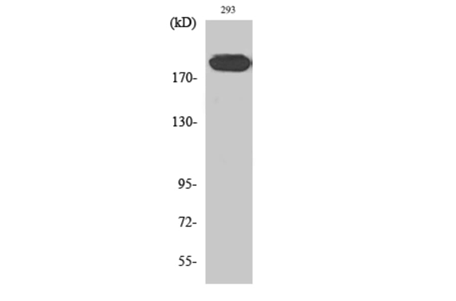 Western blot - IRS-1 Polyclonal Antibody from Signalway Antibody (41077) - Antibodies.com