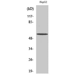 Western blot - IRTKS Polyclonal Antibody from Signalway Antibody (41078) - Antibodies.com