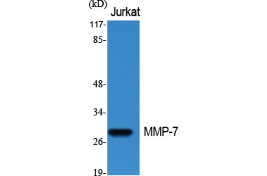 Western blot - MMP-7 Polyclonal Antibody from Signalway Antibody (41123) - Antibodies.com