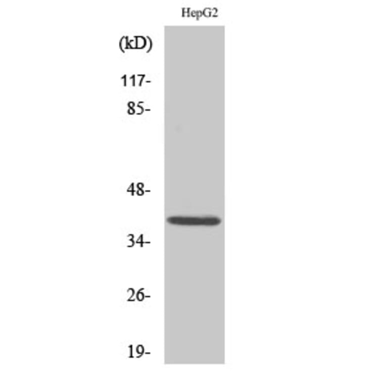 Western blot - Mcl-1 Polyclonal Antibody from Signalway Antibody (41124) - Antibodies.com