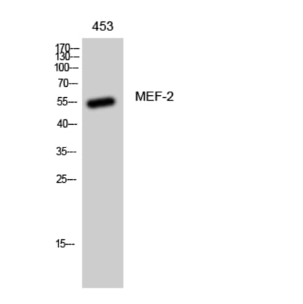 Western blot - MEF-2 Polyclonal Antibody from Signalway Antibody (41129) - Antibodies.com