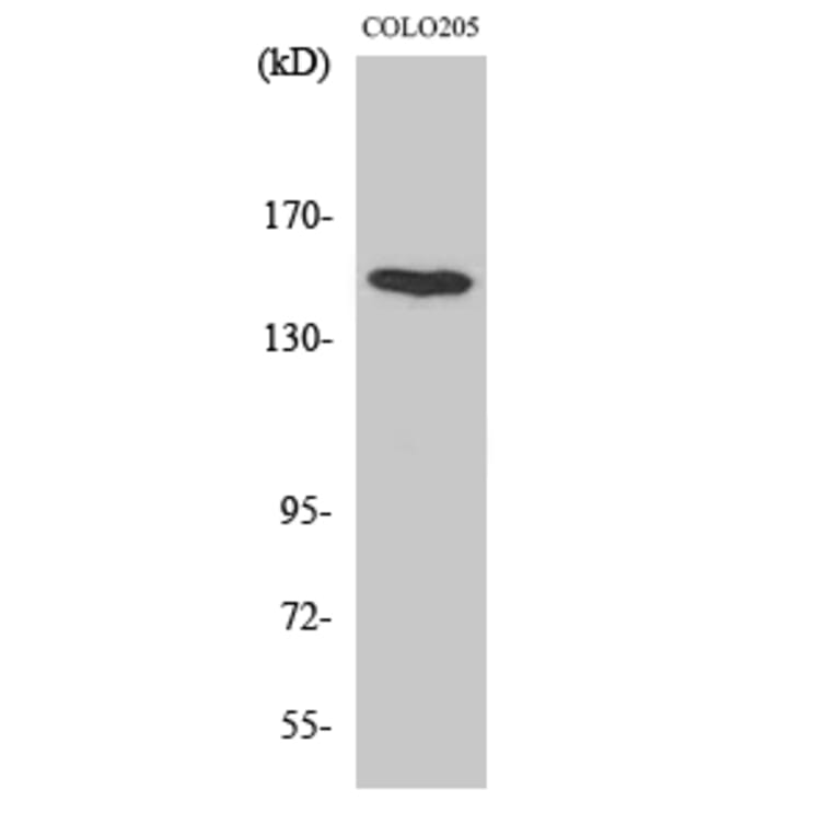 Western blot - MINK1 Polyclonal Antibody from Signalway Antibody (41144) - Antibodies.com